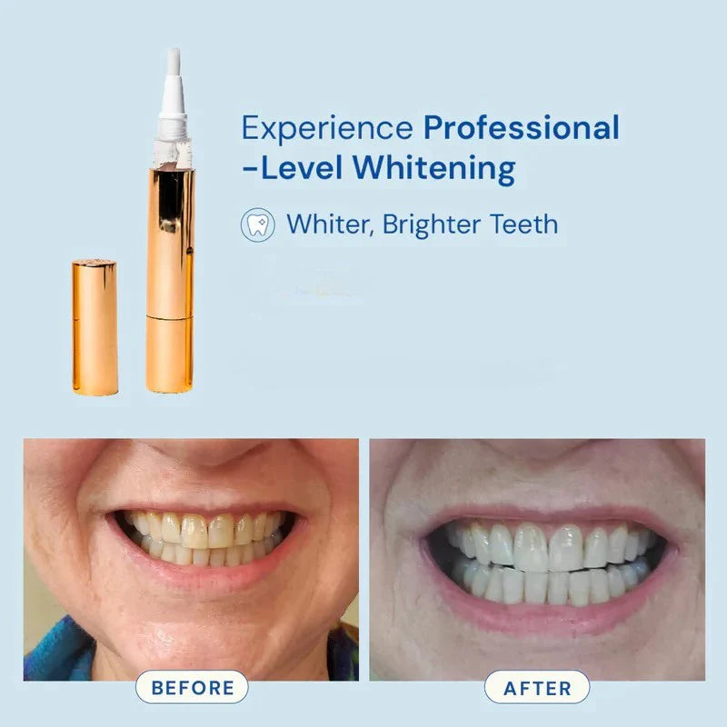Mirova Teeth Whitening Stick