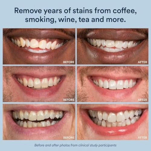 Mirova Teeth Whitening Stick